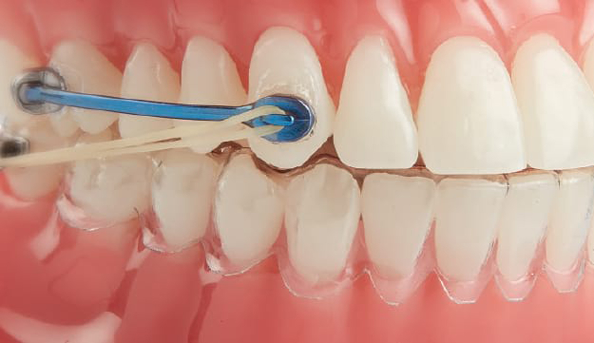 Carriere Motion 3D — Orthodontic Smile Studio A Great Smile Is For