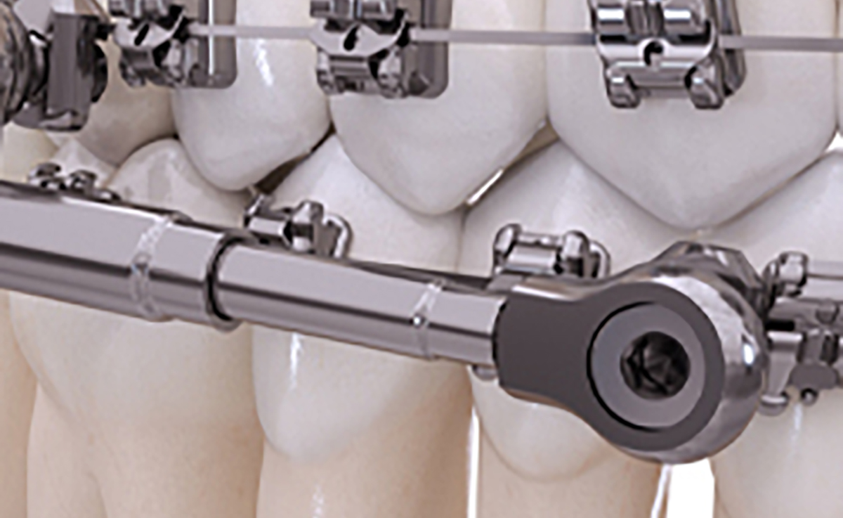 Powerscope — Orthodontic Smile Studio A Great Smile Is For Everyone